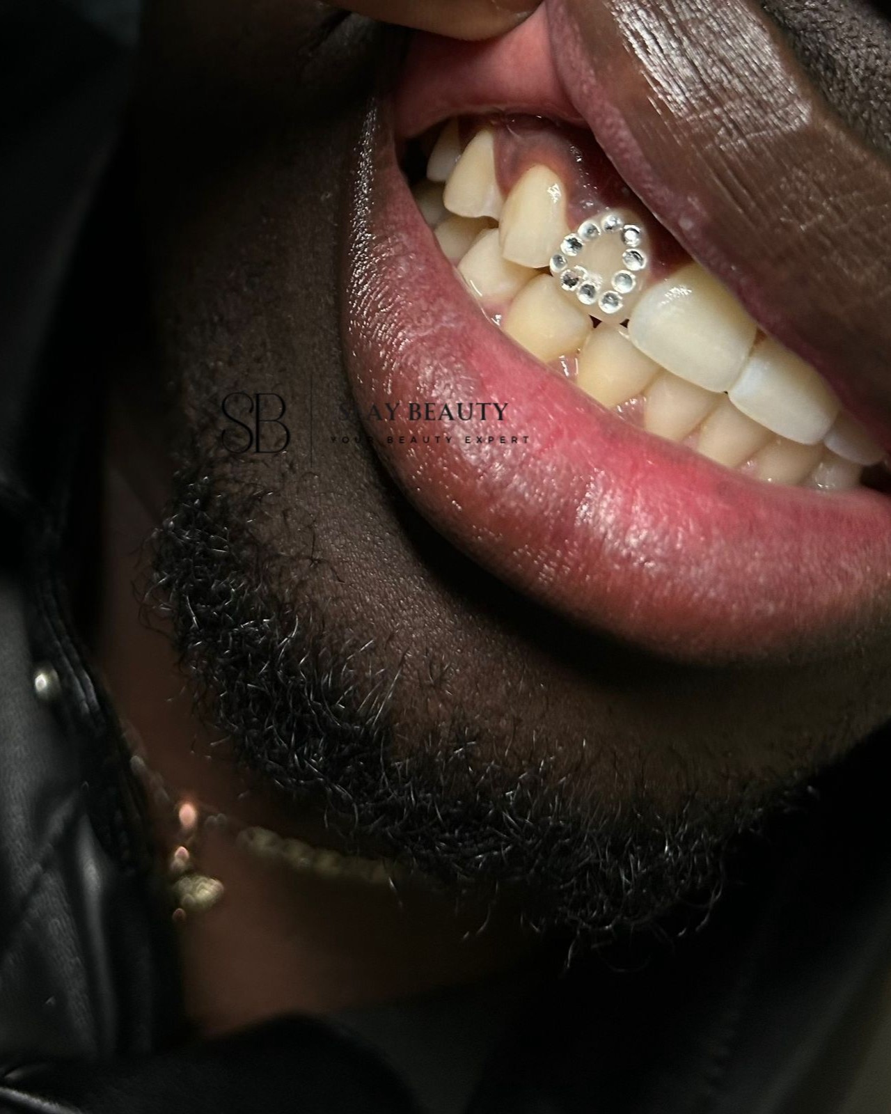 Bleaching & Tooth Gems